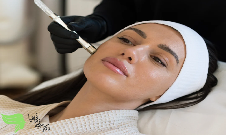 انتخاب فیشیال یا میکرودرم