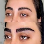 بیفور افتر کاشت ابرو