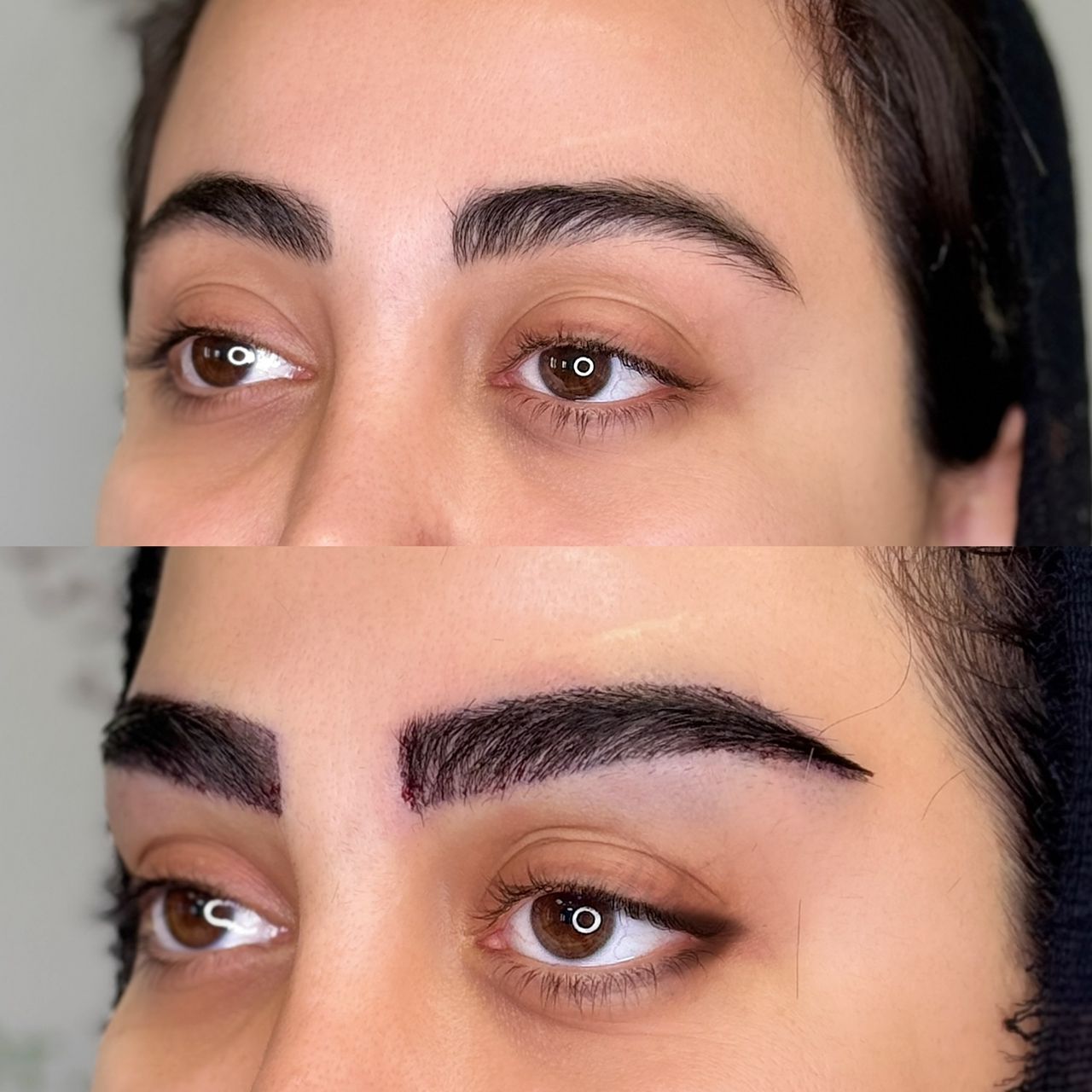 بیفور افتر کاشت ابرو