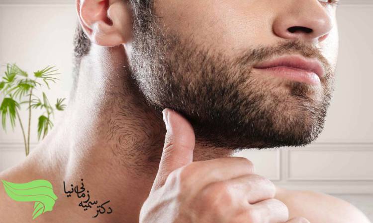 مراقبت های بعد از کاشت ریش
