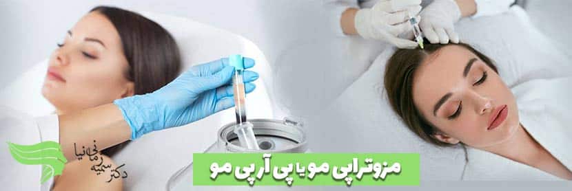 بعد از کاشت مو پی آر پی بهتر است یا مزوتراپی