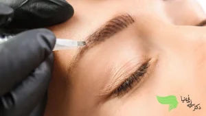 برای ترمیم ابرو چه روشی بهتری است