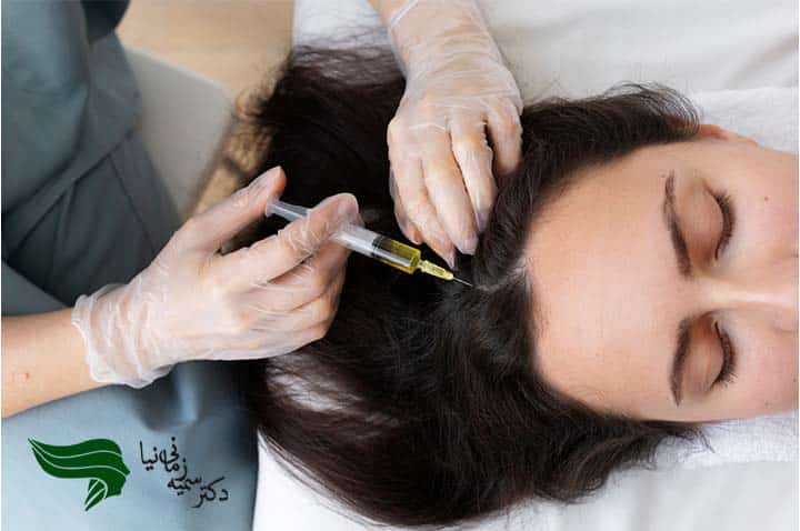 مزوتراپی سر بعد از کاشت