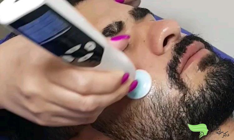فیشیال صورت