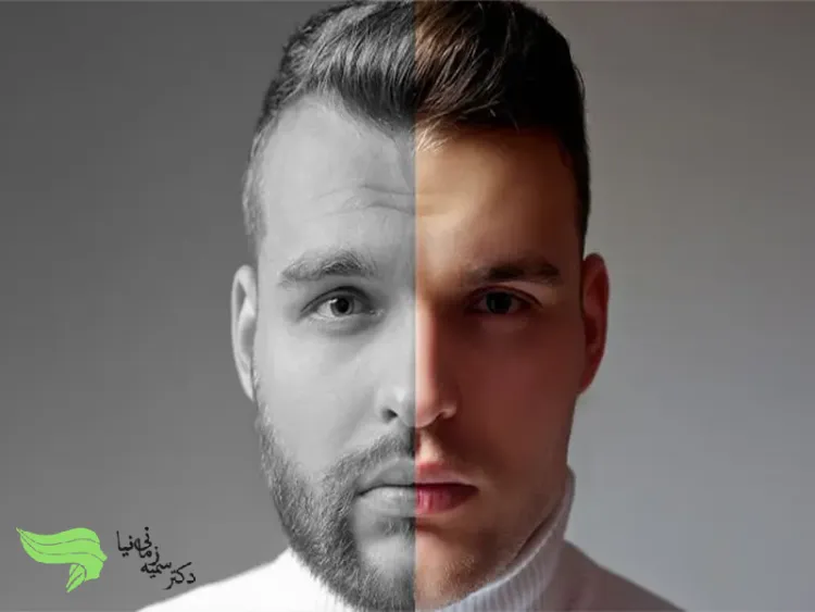 مراقبت های کاش ریش