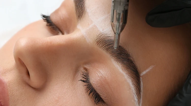 نقاهت بعد از کاشت ابرو