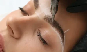 کاشت ابرو به روش sut